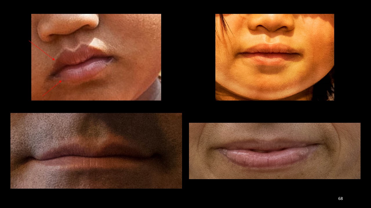 lip